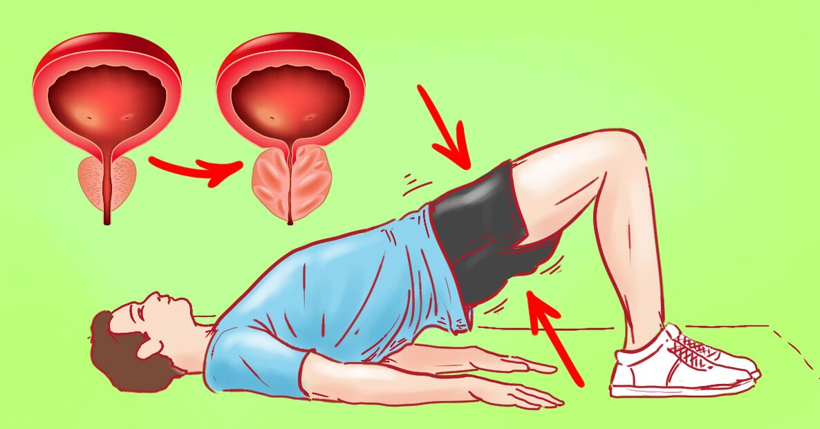 Exercicios de ximnasia para a prostatite